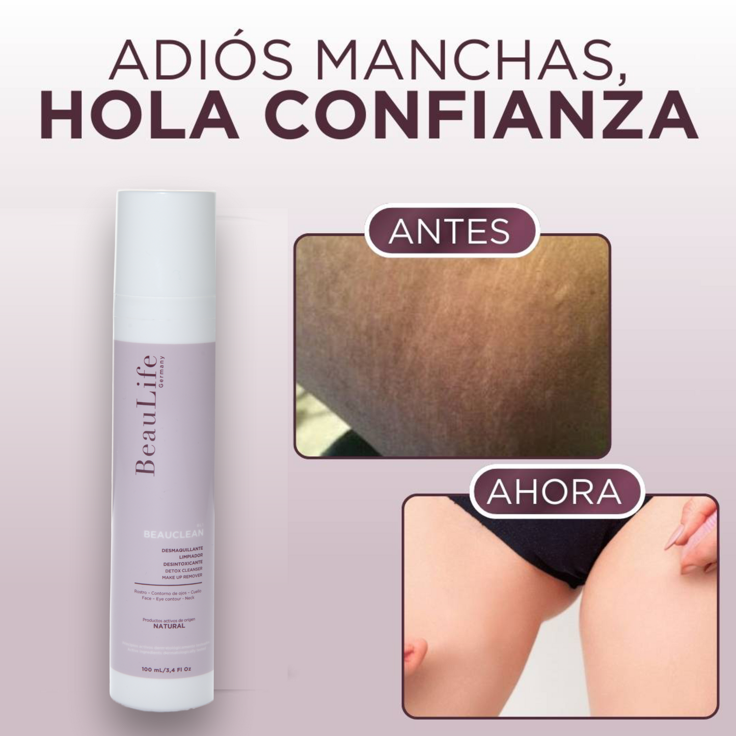 Intibelle (BL 1, Manchas y cicatrices incomodas)