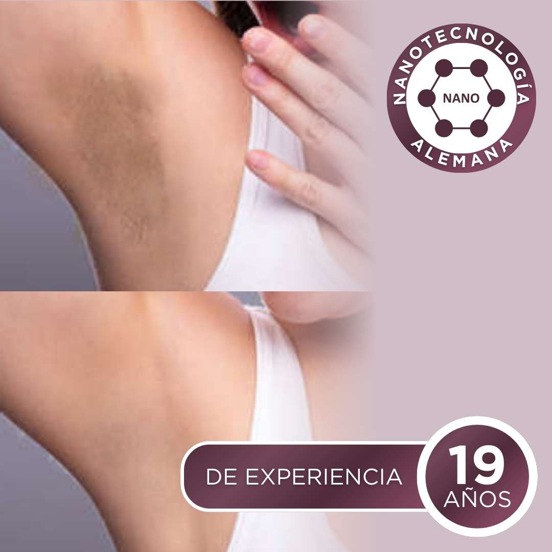 Intibelle (BL 1, Manchas y cicatrices incomodas)