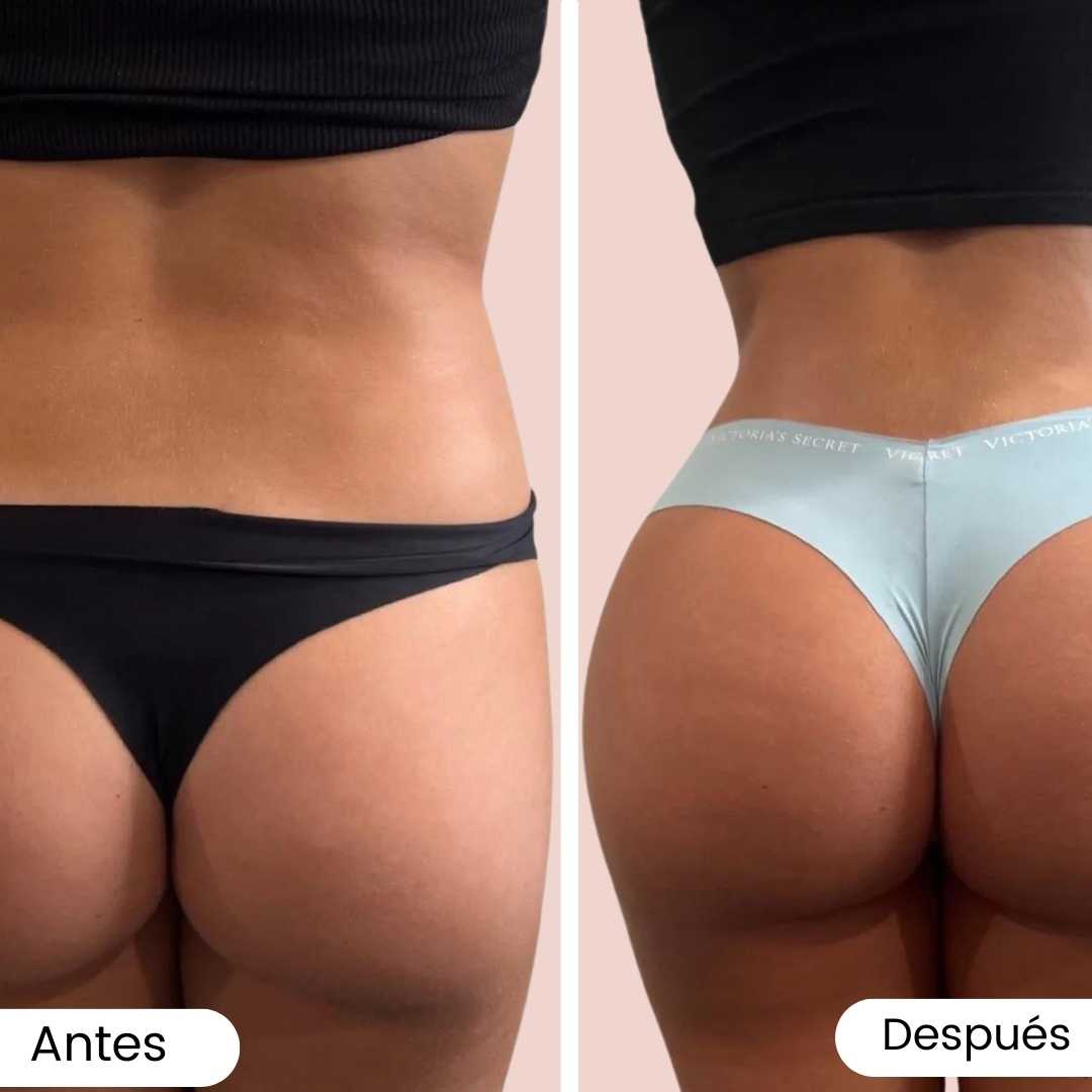 BL5 Pegante de Piel, Tonificante Corporal, Levanta Gluteos y Senos, Define Abdomen, Piernas y Brazos 250 gr